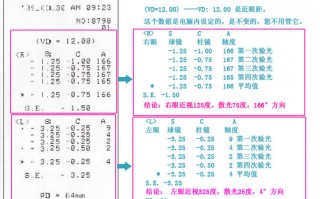 验光一次多少钱，验光一次多少钱左右